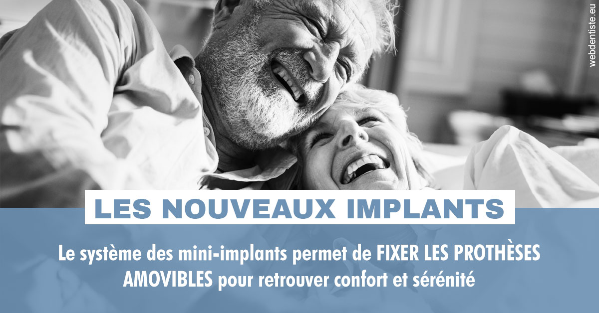 https://dr-hayat-carine.chirurgiens-dentistes.fr/Les nouveaux implants 2
