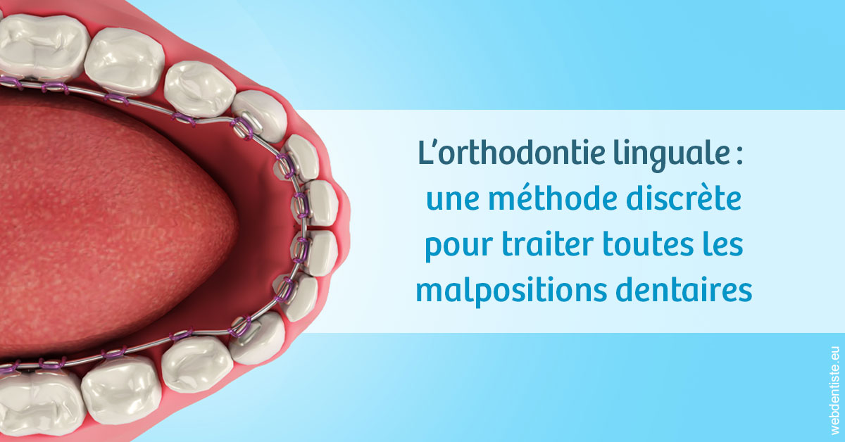 https://dr-hayat-carine.chirurgiens-dentistes.fr/L'orthodontie linguale 1