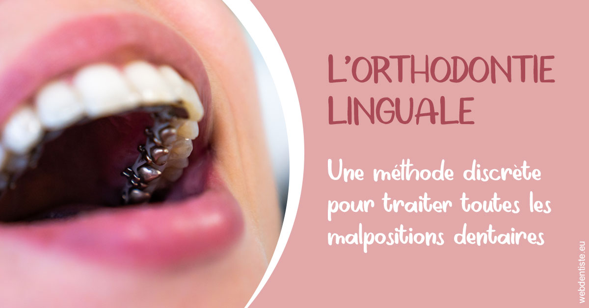 https://dr-hayat-carine.chirurgiens-dentistes.fr/L'orthodontie linguale 2