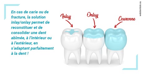 https://dr-hayat-carine.chirurgiens-dentistes.fr/L'INLAY ou l'ONLAY