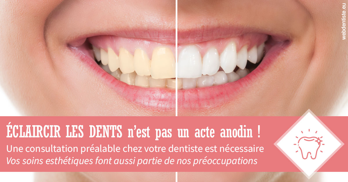 https://dr-hayat-carine.chirurgiens-dentistes.fr/Eclaircir les dents 1