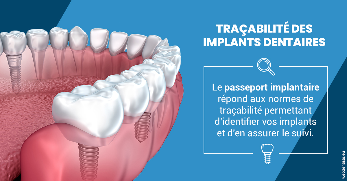 https://dr-hayat-carine.chirurgiens-dentistes.fr/T2 2023 - Traçabilité des implants 1