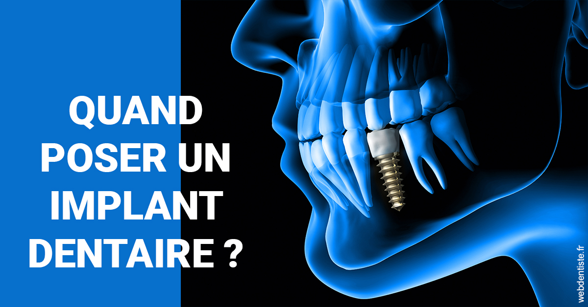 https://dr-hayat-carine.chirurgiens-dentistes.fr/Les implants 1