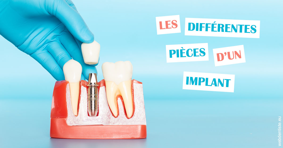 https://dr-hayat-carine.chirurgiens-dentistes.fr/Les différentes pièces d’un implant 2