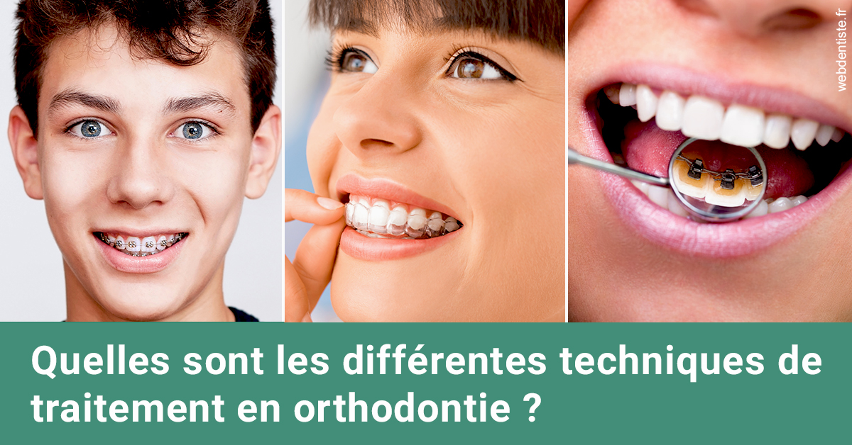 https://dr-hayat-carine.chirurgiens-dentistes.fr/Les différentes techniques de traitement 2