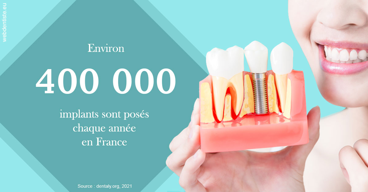 https://dr-hayat-carine.chirurgiens-dentistes.fr/Pose d'implants en France 2