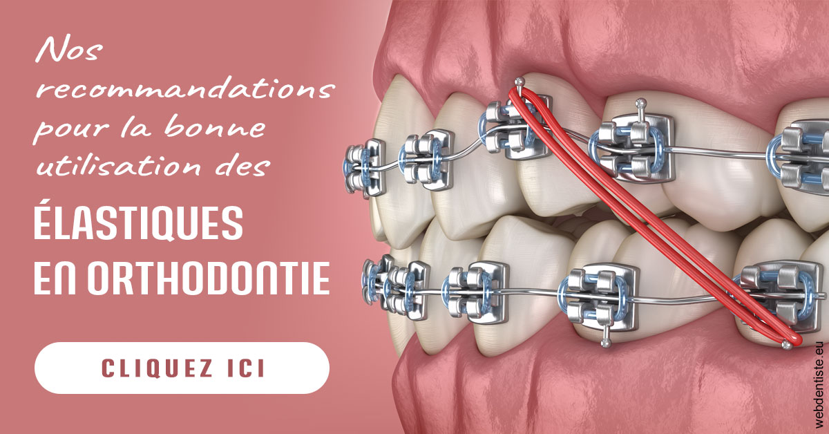 https://dr-hayat-carine.chirurgiens-dentistes.fr/Elastiques orthodontie 2